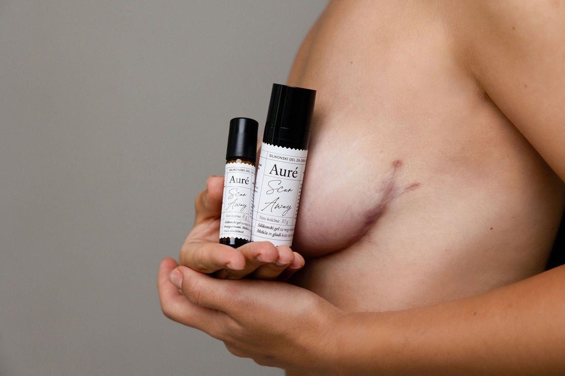 Kako negovati brazgotine za mehkejšo, bolj gladko in prožno kožo